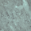IHC on rat brain using Rabbit antibody to VPS45A (STJ13100462) at a concentration of 10 ug/ml. Pre-absorption of the antibody with the immunising peptide completely abolishes the immunostaining (not shown) .