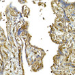 Immunohistochemistry analysis of paraffin-embedded human placenta using IFIH1 Rabbit polyclonal antibody (STJ115604) at dilution of 1:50 (40x lens). Perform high pressure antigen retrieval with 10 mM citrate buffer pH 6. 0 before commencing with immunohistochemistry staining protocol.
