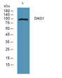 Western blot analysis of lysates from K562 cells, primary antibody was diluted at 1:1000, 4°C over night