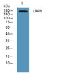 Western blot analysis of lysates from SH-SY5Y cells, primary antibody was diluted at 1:1000, 4°C over night