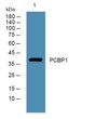 Western blot analysis of lysates from PC12 cells, primary antibody was diluted at 1:1000, 4°C over night