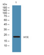 Western blot analysis of lysates from K562 cells, primary antibody was diluted at 1:1000, 4°C over night