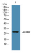Western blot analysis of lysates from A431 cells, primary antibody was diluted at 1:1000, 4°C over night