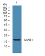 Western blot analysis of lysates from SW480 cells, primary antibody was diluted at 1:1000, 4°C over night