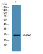 Western blot analysis of lysates from SH-SY5Y cells, primary antibody was diluted at 1:1000, 4°C over night Western blot analysis of lysates from SH-SY5Y cells, primary antibody was diluted at 1:1000, 4°C over night
