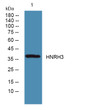 Western blot analysis of lysates from DU145 cells, primary antibody was diluted at 1:1000, 4°C over night