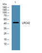 Western blot analysis of lysates from HCT116 cells, primary antibody was diluted at 1:1000, 4°C over night