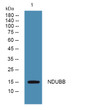 Western blot analysis of lysates from SH-SY5Y cells, primary antibody was diluted at 1:1000, 4°C over night
