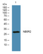 Western blot analysis of lysates from K562 cells, primary antibody was diluted at 1:1000, 4°C over night