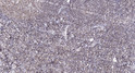 Immunohistochemical analysis of paraffin-embedded human tonsil. 1, Antibody was diluted at 1:200 (4°C overnight). 2, Tris-EDTA, pH9.0 was used for antigen retrieval. 3, Secondary antibody was diluted at 1:200 (room temperature, 45min).
