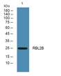 Western blot analysis of lysates from A431 cells, primary antibody was diluted at 1:1000, 4°C over night