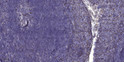 Immunohistochemical analysis of paraffin-embedded human tonsil. 1, Antibody was diluted at 1:200 (4°C overnight). 2, Tris-EDTA, pH9.0 was used for antigen retrieval. 3, Secondary antibody was diluted at 1:200 (room temperature, 30min).