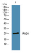Western blot analysis of lysates from SH-SY5Y cells, primary antibody was diluted at 1:1000, 4°C over night