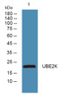 Western blot analysis of lysates from HCT116 cells, primary antibody was diluted at 1:1000, 4°C over night
