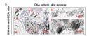 Macrophage lineage cells-derived migrasomes activate complement-dependent blood-brain barrier damage in cerebral STJ191677