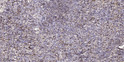 Immunohistochemical analysis of paraffin-embedded human spleen tissue. 1, primary Antibody was diluted at 1:200 (4°C overnight). 2, Sodium citrate pH 6.0 was used for antigen retrieval (>98°C, 20min). 3, Secondary antibody was diluted at 1:200