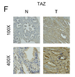 Immunohistochemistry - Paraffin (IHC-P): A Liquid–Liquid Phase Separation-Related Index Associated with Biochemical STJ191805