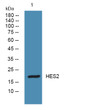 Western blot analysis of lysates from HCT116 cells, primary antibody was diluted at 1:1000, 4°C over night