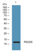 Western blot analysis of lysates from DU145 cells, primary antibody was diluted at 1:1000, 4°C over night