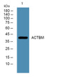 Western blot analysis of lysates from HCT116 cells, primary antibody was diluted at 1:1000, 4°C over night
