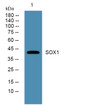 Western blot analysis of lysates from SW480 cells, primary antibody was diluted at 1:1000, 4°C over night