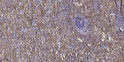 Immunohistochemical analysis of paraffin-embedded human spleen tissue. 1, primary Antibody was diluted at 1:200 (4°C overnight). 2, Sodium citrate pH 6.0 was used for antigen retrieval (>98°C, 20min). 3, Secondary antibody was diluted at 1:200