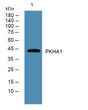 Western blot analysis of lysates from SW480 cells, primary antibody was diluted at 1:1000, 4°C over night