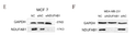 Integrating Single-Cell RNA-Seq and Bulk RNA-Seq Data to Explore the Key Role of Fatty Acid Metabolism in Breast STJ193077