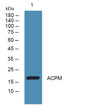 Western blot analysis of lysates from KB cells, primary antibody was diluted at 1:1000, 4°C overnight STJ193077