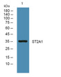 Western blot analysis of lysates from KB cells, primary antibody was diluted at 1:1000, 4°C overnight STJ193153