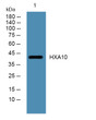 Western blot analysis of lysates from K562 cells, primary antibody was diluted at 1:1000, 4°C overnight STJ193159