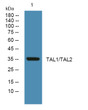 Western blot analysis of lysates from A431 cells, primary antibody was diluted at 1:1000, 4° overnight STJ193182
