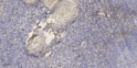 Immunohistochemical analysis of paraffin-embedded human tonsil. 1, Antibody was diluted at 1:200 (4° overnight). 2, STJ193188
