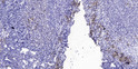 Immunohistochemical analysis of paraffin-embedded human tonsil. 1, Antibody was diluted at 1:200 (4°C overnight). 2, Tris-EDTA, pH9.0 was used for antigen retrieval. 3, Secondary antibody was diluted at 1:200 (room temperature, 45min). Immunohistochemical analysis of paraffin-embedded human tonsil. 1, Antibody was diluted at 1:200 (4°C overnight). 2, Tris-EDTA, pH9.0 was used for antigen retrieval. 3, Secondary antibody was diluted at 1:200 (room temperature, 45min).