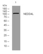 Western blot analysis of lysates from MCF-7 cells, primary antibody was diluted at 1:1000, 4°C over night