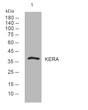 Western blot analysis of lysates from MCF-7 cells, primary antibody was diluted at 1:1000, 4°C over night