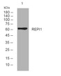 Western blot analysis of lysates from KB cells, primary antibody was diluted at 1:1000, 4°C over night