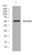 Western blot analysis of lysates from A431 cells, primary antibody was diluted at 1:1000, 4°C over night