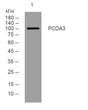 Western blot analysis of lysates from MCF-7 cells, primary antibody was diluted at 1:1000, 4°C over night