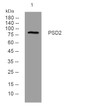 Western blot analysis of lysates from CACO2 cells, primary antibody was diluted at 1:1000, 4°C over night