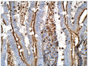 Immunohistochemistry of rat small intestine with Anti-ANGPTL5 primary antibody (STJ500084) at 1:50 dilution in Buffer. Section was treated with DAB and Haematoxylin stain. Magnification is at 40X. Immunohistochemistry of rat small intestine with Anti-ANGPTL5 primary antibody (STJ500084) at 1:50 dilution in Buffer. Section was treated with DAB and Haematoxylin stain. Magnification is at 40X.
