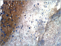 Immunohistochemistry with Anti-ARF1 Antibody (STJ500153) at 1:50 dilution in Buffer. DAB (brown) staining and Haematoxylin QS (blue) counterstain. 40X magnification. FFPE section.
