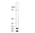 Western blot with Anti-Beta crystallin S Antibody (STJ500306) with peptide on at 1:750 dilution in buffer.