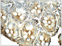 Immunohistochemistry of baboon Large Intestine with Anti-CDH17 primary antibody (STJ500340) at 1:50 dilution in Buffer. Section was treated with DAB and Haematoxylin stain. Magnification is at 40X.