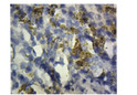 Immunohistochemistry with Anti-CD36 Antibody (STJ500463) at 1:200 dilution in Buffer. Counterstained with haematoxylin.