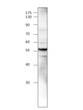 Western blot with Anti-KRT20 Antibody (STJ500540) of MDA cell at 1:500 dilution in buffer.