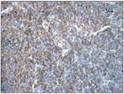 Immunohistochemistry of rat tissue with Anti-CTNNB1 primary antibody (STJ500624) at 1:100 dilution in Buffer. Section was treated with DAB and Haematoxylin stain. Magnification is at 40X.