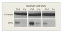 Anti-SLC31A1 Antibody (STJ500630) on Ovarian cancer. Copper treatment down regulates CTR1 in Various Ovarian cancer cell lines.