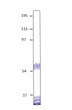 Western blot with Anti-Dopamine D5 Receptor Antibody (STJ500720) with peptide on at 1:750 dilution in buffer.