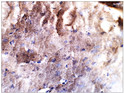 Immunohistochemistry of rat brain with Anti-SLC6A3 primary antibody (STJ500735) at 1:50 dilution in Buffer. Section was treated with DAB and Haematoxylin stain. Magnification is at 40X.